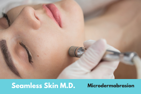 Close-up of a microdermabrasion procedure targeting the cheek, showcasing the expert skin renewal treatments available for microdermabrasion Santa Fe at Seamless Skin MD.