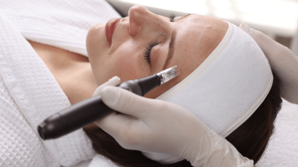 Woman receiving microneedling Santa Fe treatment